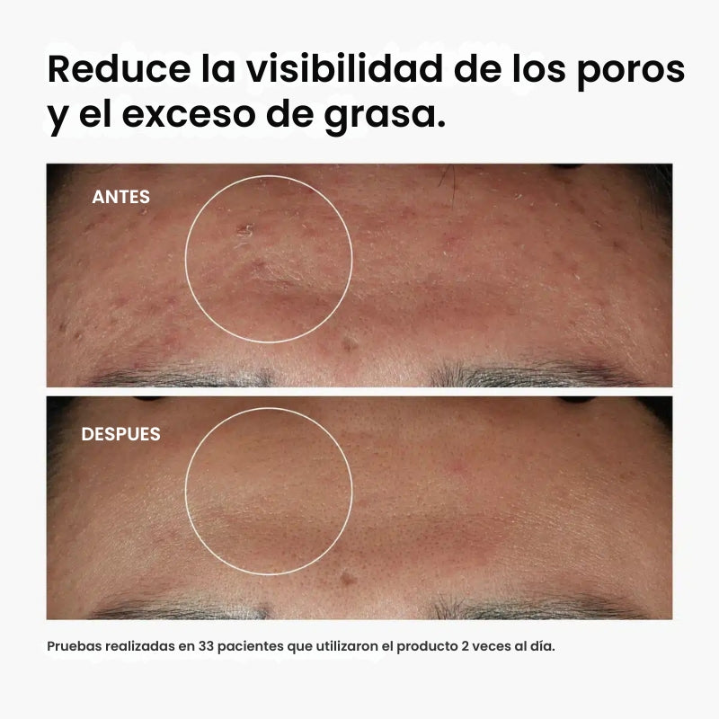 The Ordinary - Adiós granitos, hola seguridad - OFERTA 2X1