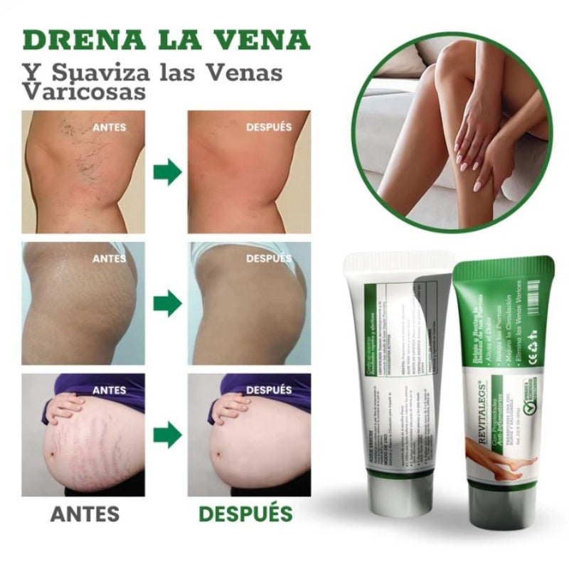 REVITALEGS® - Crema para Eliminar Venas Varices