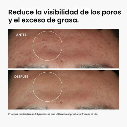 The Ordinary - Adiós granitos, hola seguridad - OFERTA 2X1