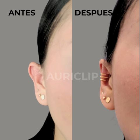 Correctores de oreja - ¡Junior!
