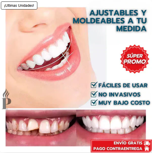 Carillas Instant Smile™: ocultan manchas, espacios y torceduras en minutos 🔥OFERTA 2X1🔥