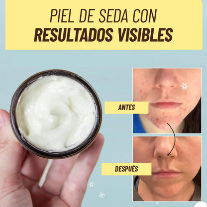 FacialTallow - Crema Facial de Sebo y Miel