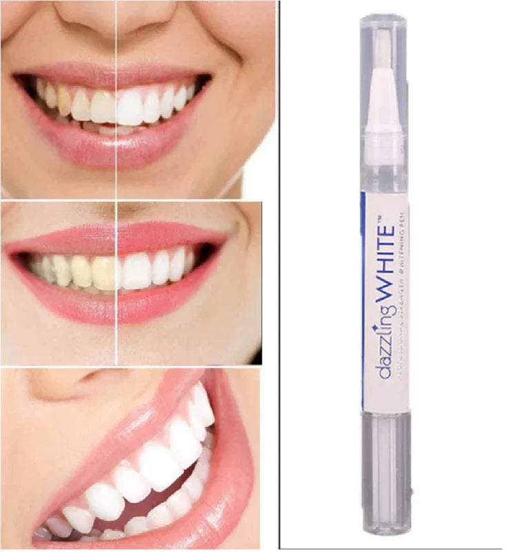 Lápiz Blanqueador de Dientes. Sonrisa Radiante 🔥2x1🔥